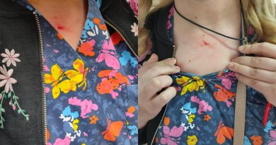 65 yaşındaki kadın sağlık çalışanını boğazından yaraladı