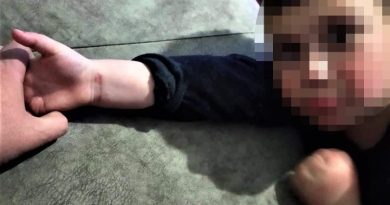 Anne şiddeti iddiasıyla 5 yaşındaki çocuğunun velayetini istiyor