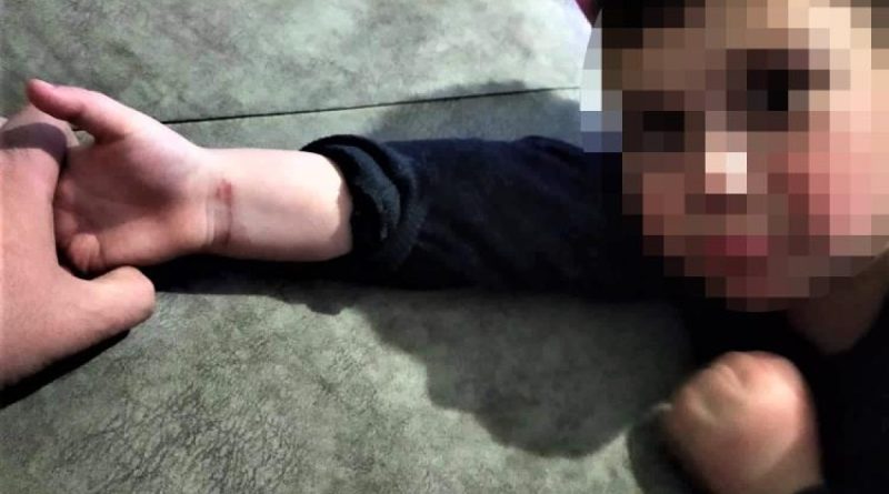 Anne şiddeti iddiasıyla 5 yaşındaki çocuğunun velayetini istiyor