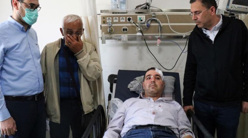 ‘Beni taciz, rahatsız ediyorsun’ diyerek saldırdığı aile hekiminin burnunu kırdı