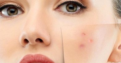 Hassas ve alerjik ciltlere mevsim geçişlerinde dikkat