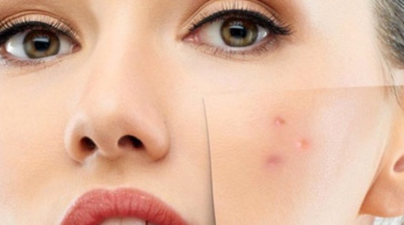 Hassas ve alerjik ciltlere mevsim geçişlerinde dikkat