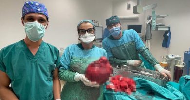 Kars’ta 65 yaşındaki kadından 6 kilo kitle çıkarıldı