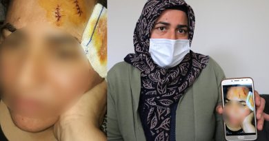 Komşuya tencereli darp