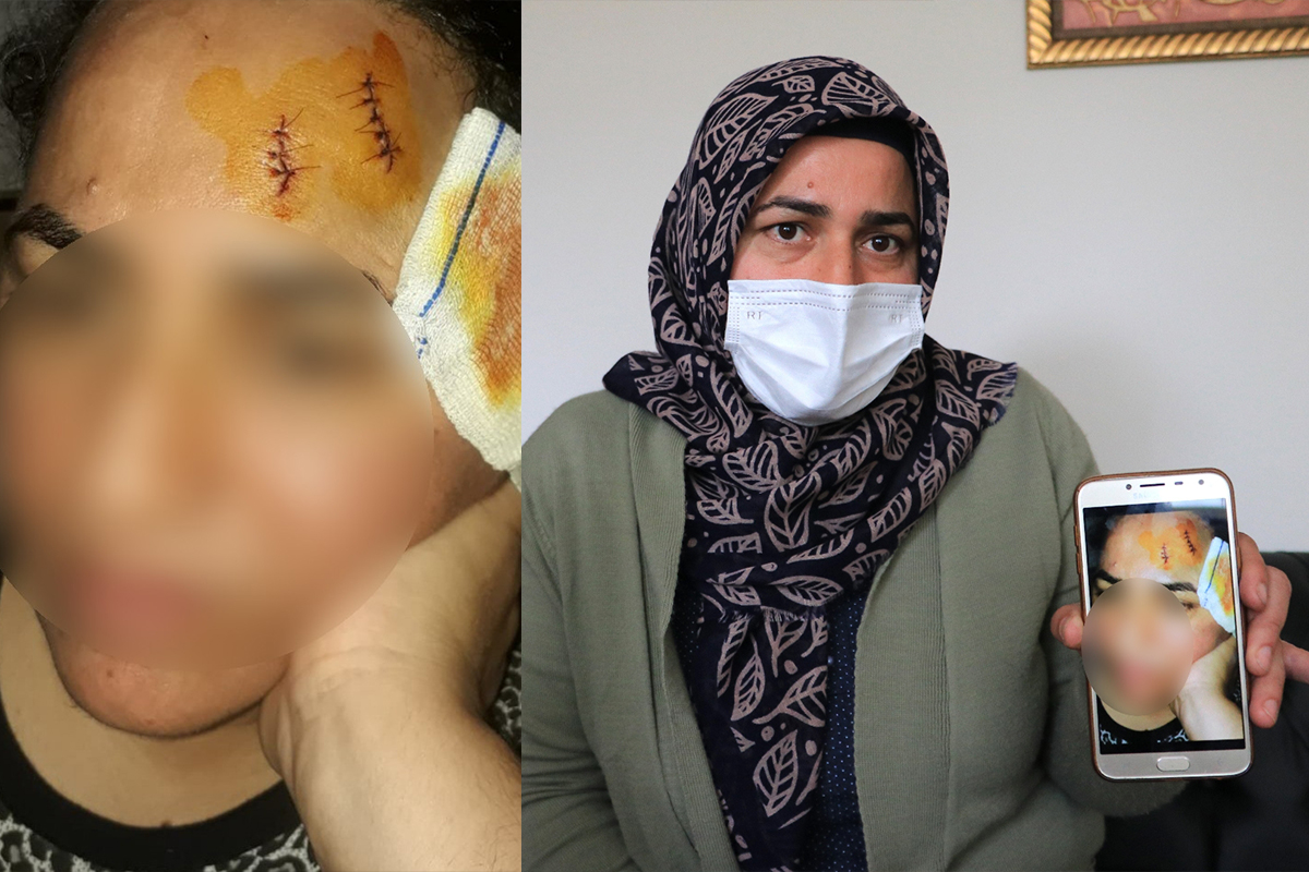 Komşuya tencereli darp