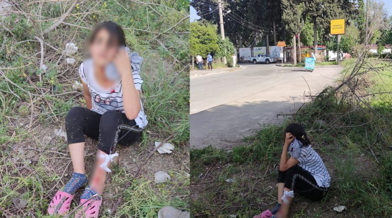 Sokak köpekleri küçük çocuğu yaraladı