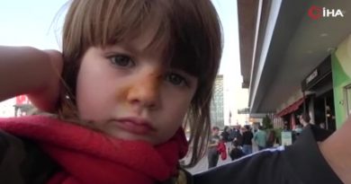 Taksim’de köpek İranlı çocuğu burnundan ısırdı