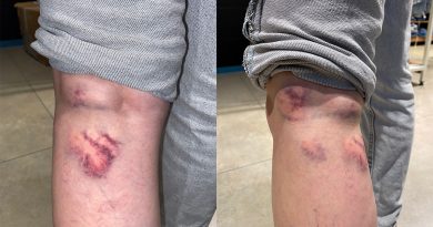 29 yaşındaki Hasret, sokakta dehşeti yaşadı