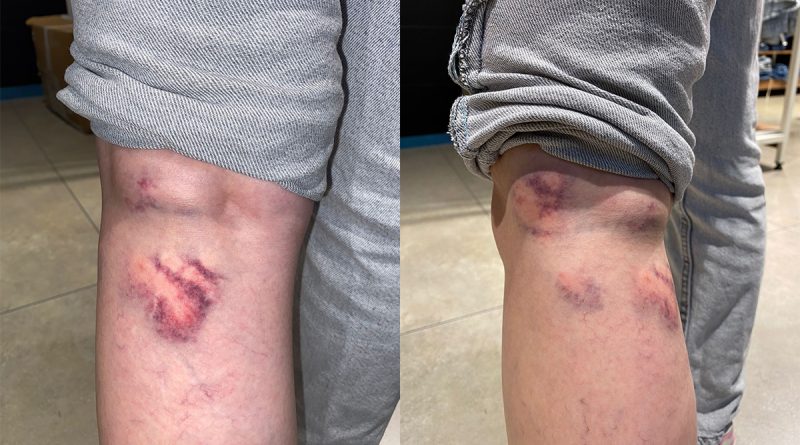 29 yaşındaki Hasret, sokakta dehşeti yaşadı