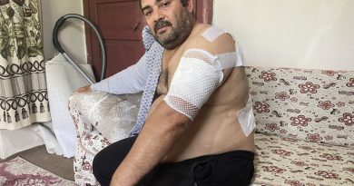 Ayı saldırısına uğrayan vatandaş: 'Beni öldü zannetti'