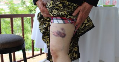 Başıboş köpeklerin saldırdığı yaşlı kadın ölümden döndü