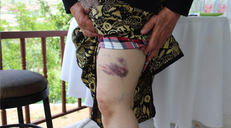 Başıboş köpeklerin saldırdığı yaşlı kadın ölümden döndü