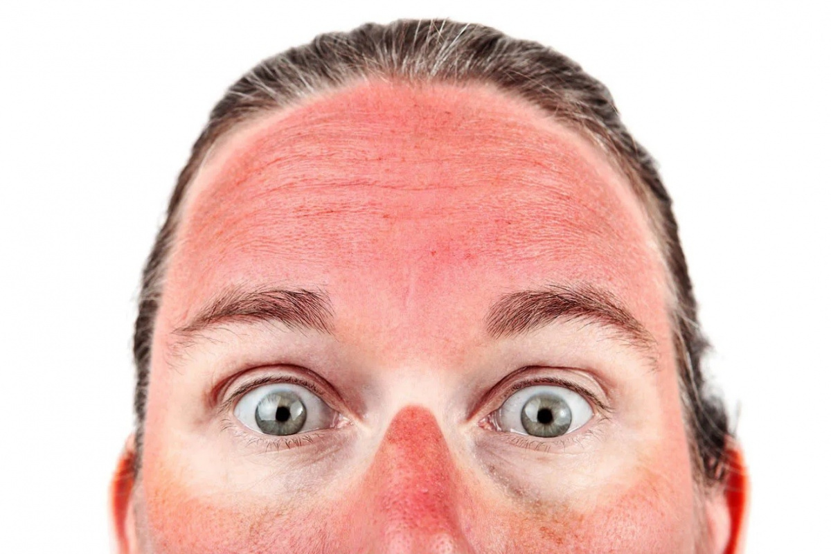 'Bronzlaşma aslında derinin kendini koruma mekanizmasıdır'