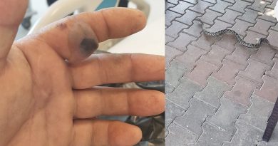 Bursa’da bir adam elini sokan yılanla hastaneye koştu