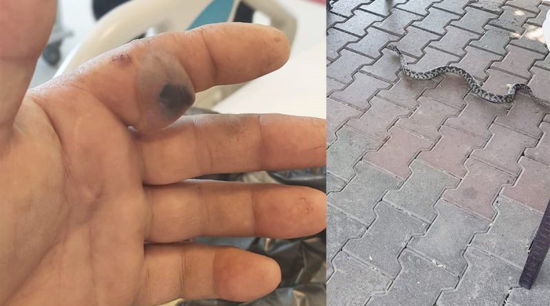 Bursa’da bir adam elini sokan yılanla hastaneye koştu