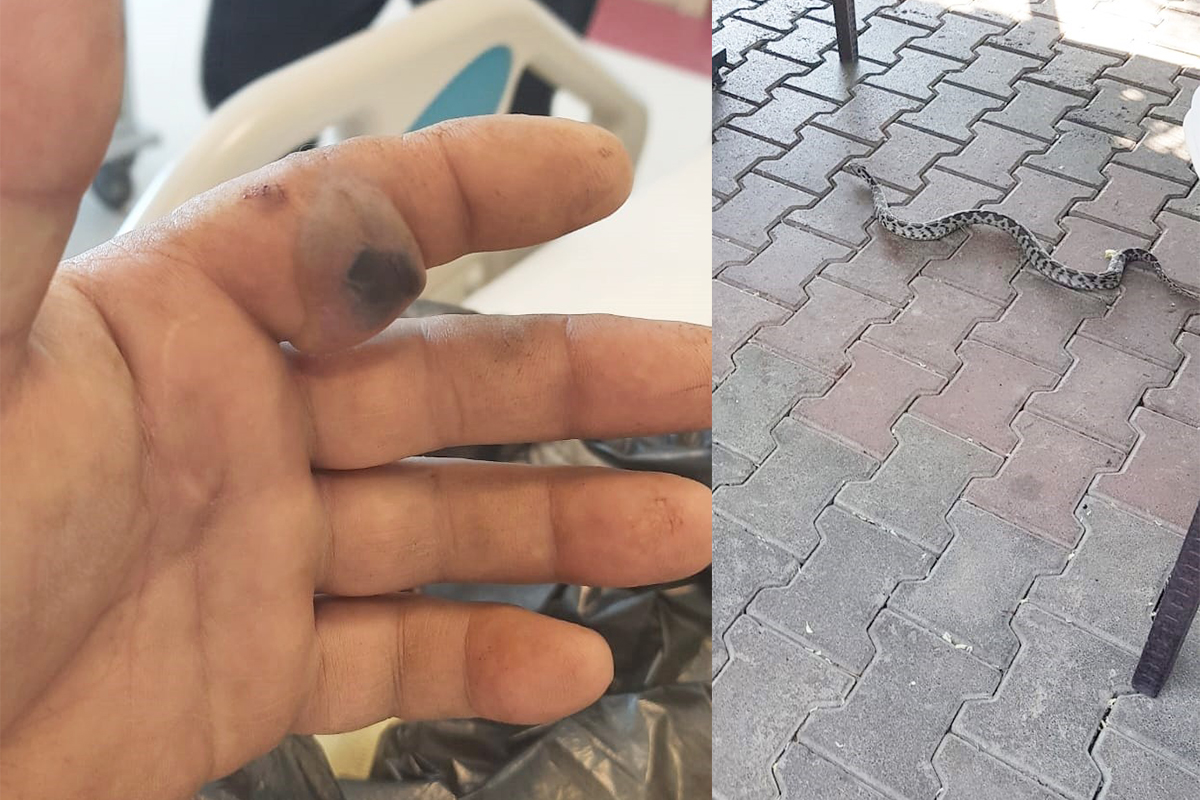 Bursa’da bir adam elini sokan yılanla hastaneye koştu
