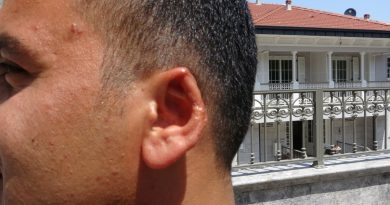 Film senaryolarını aratmayacak olay: Kavgada kopan kulağını martı kaptı