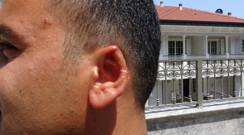 Film senaryolarını aratmayacak olay: Kavgada kopan kulağını martı kaptı