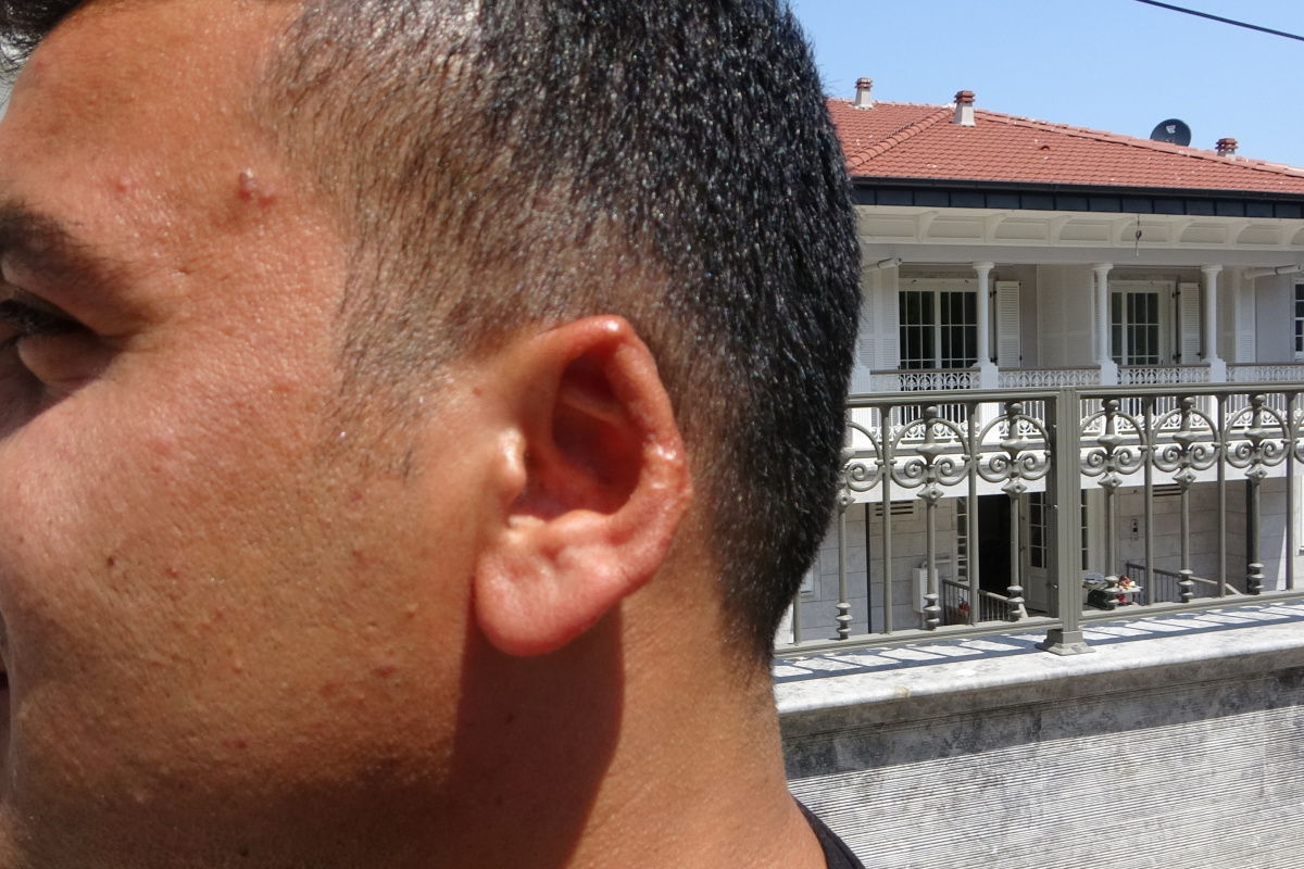 Film senaryolarını aratmayacak olay: Kavgada kopan kulağını martı kaptı