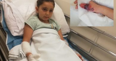 Kadıköy’de hastanede MR çekilen küçük kızın parmakları ve kolu yandı