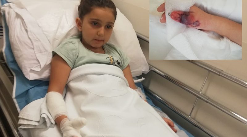 Kadıköy’de hastanede MR çekilen küçük kızın parmakları ve kolu yandı