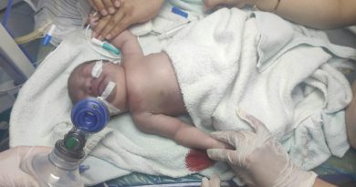 Yeni doğan bebeğin köprücük kemiği kırıldı, vücudu mosmor oldu