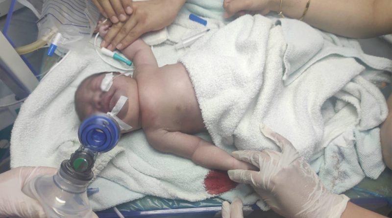 Yeni doğan bebeğin köprücük kemiği kırıldı, vücudu mosmor oldu