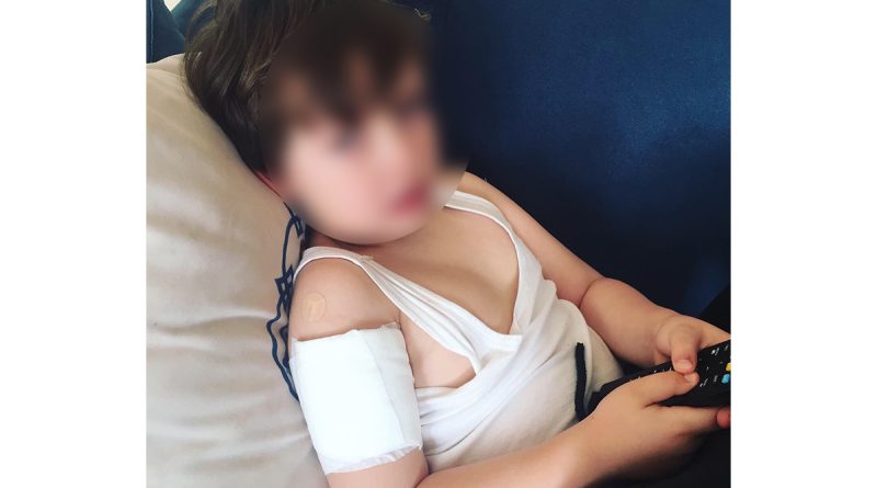 Zonguldak’ta sahipsiz köpekler 5 yaşındaki çocuğa saldırdı