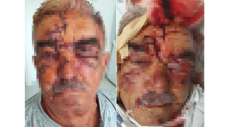 Beslediği komşusunun köpeğinin saldırısına uğradı