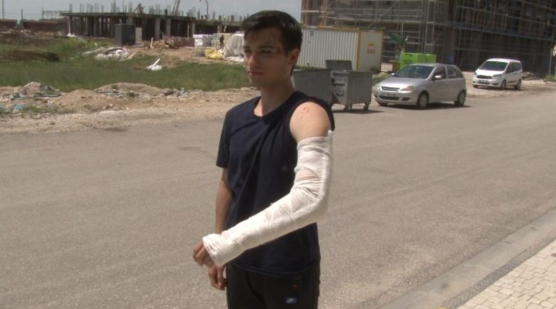 Bisikletiyle üniversiteye giden öğrenci sokak köpeklerinin saldırısına uğradı