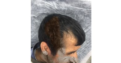 Çöpteki geri dönüşüm atıklarını paylaşamayan çekçekçi arkadaşını sopayla dövdü