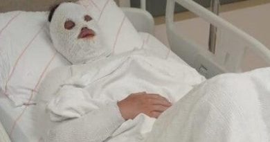 Eski nişanlısına kezzap atan şahıs "Su saatine bakacağım" bahanesiyle kapıyı açtırmış