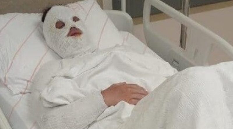 Eski nişanlısına kezzap atan şahıs "Su saatine bakacağım" bahanesiyle kapıyı açtırmış