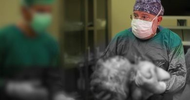 Kadın hastanın karnından 16,9 kiloluk dev kitle çıktı, 40 yıllık doktor bile şaşırdı