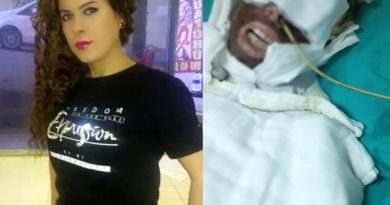 Kimyasalla yaktığı kadını yatağa mahkum eden sanığın yargılanmasına devam edildi