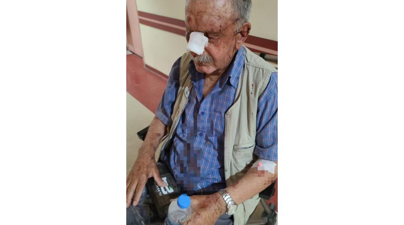 Miras davası yüzünden darp edilen yaşlı çift yaşam savaşı veriyor