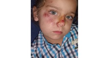 Sokak köpeği, sırtından ısırdığı çocuğu yüz üstü sürükledi