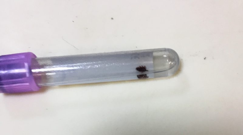 Vücuduna yapışan kene acil serviste çıkarıldı