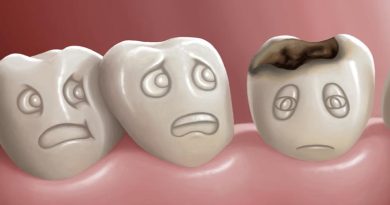 Diş Çürüğünün Nedenleri ve Belirtileri Nelerdir?